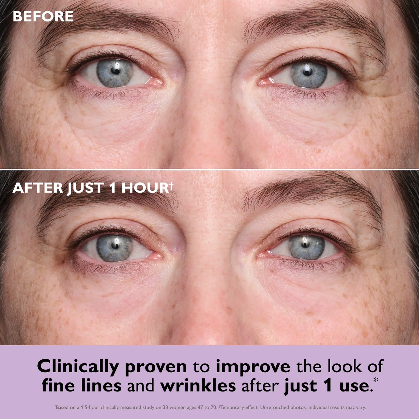 Instant FIRMx Collagen Infusion Tightening Eye Patches: A Revolution for Your Under - Eyes