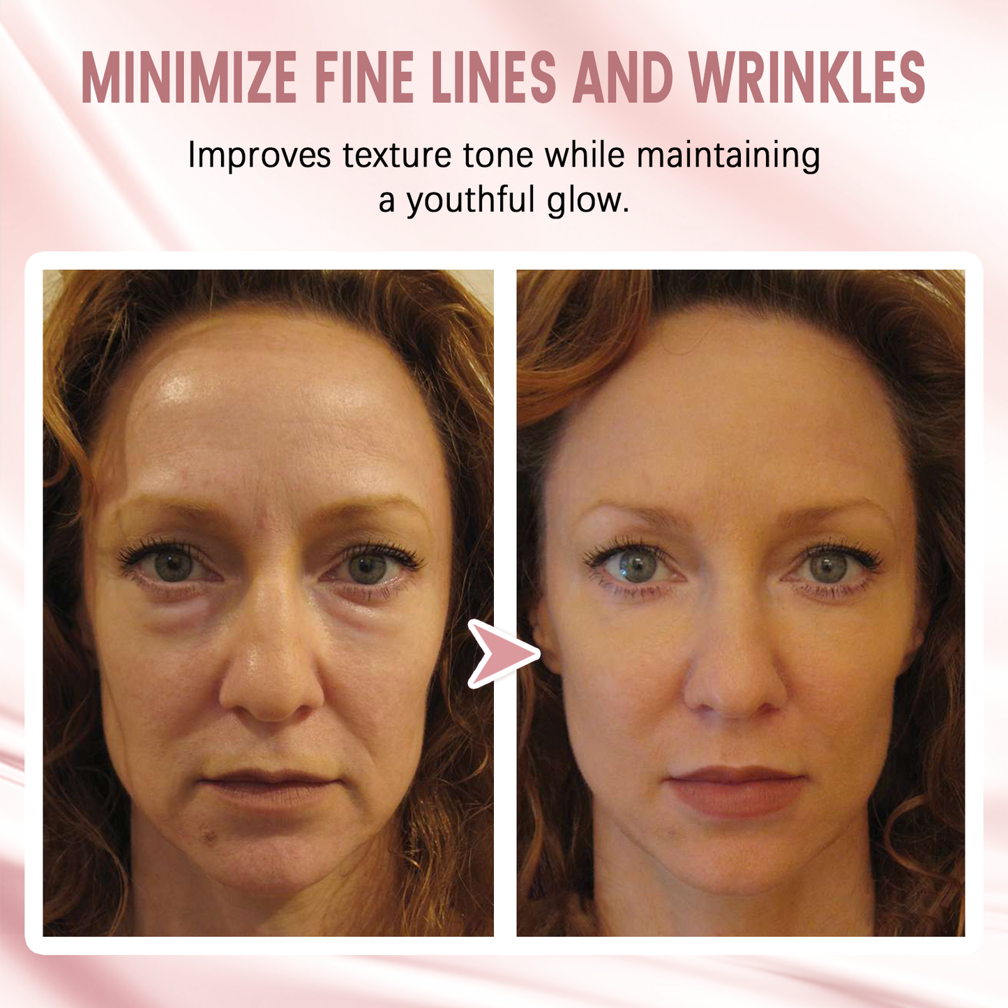 🎄Last Day Discount: 87% OFF 🌸【Official Brand Store】Second Generation Instant Face Tightener & Primer🌟