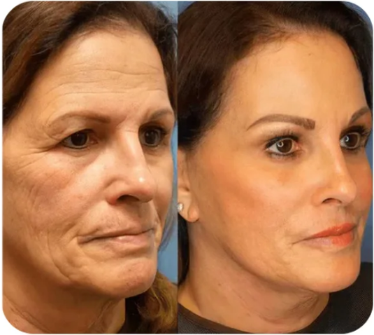 đĽăOfficial Brand StoreăPerfection Primer Tightener No-Filter Primer(Limited Time Discount)