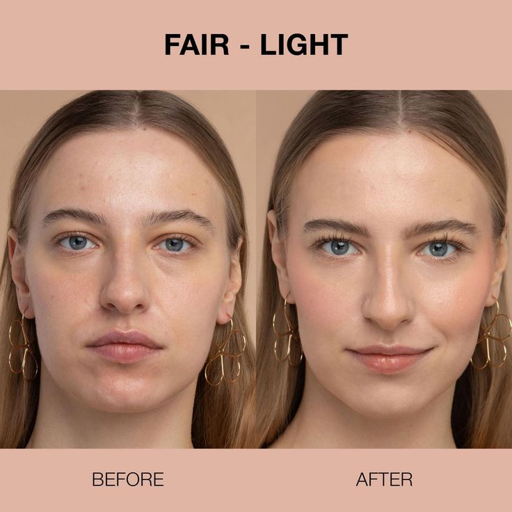Instant FIRMx Collagen Infusion Tightening Eye Patches: A Revolution for Your Under - Eyes