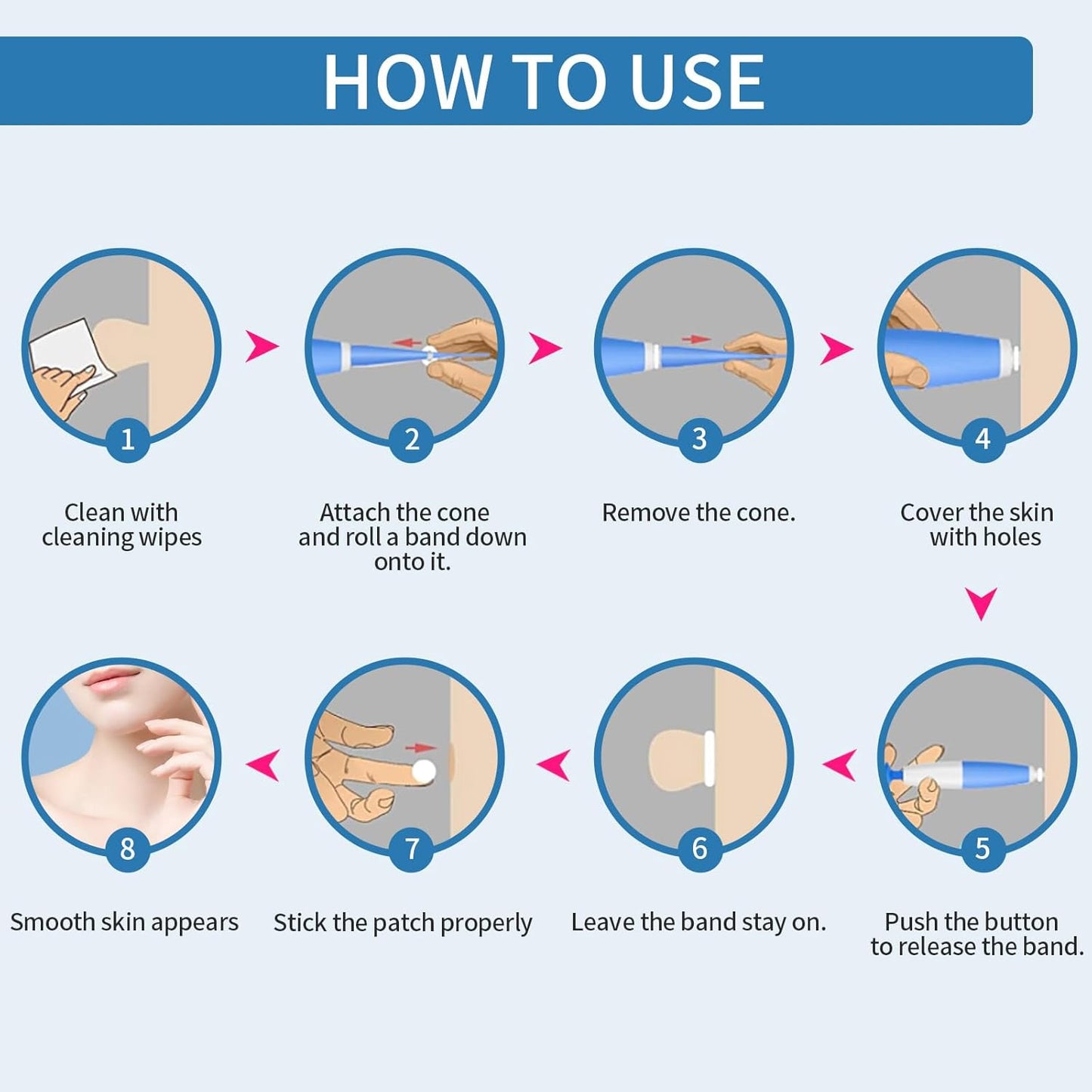 DermaTag Removal Kit
