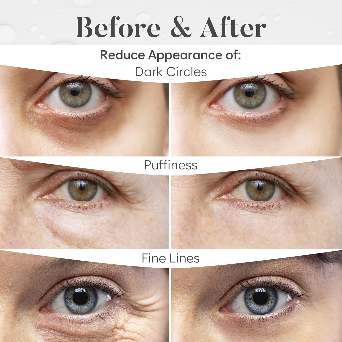 Instant FIRMx Collagen Infusion Tightening Eye Patches: A Revolution for Your Under - Eyes