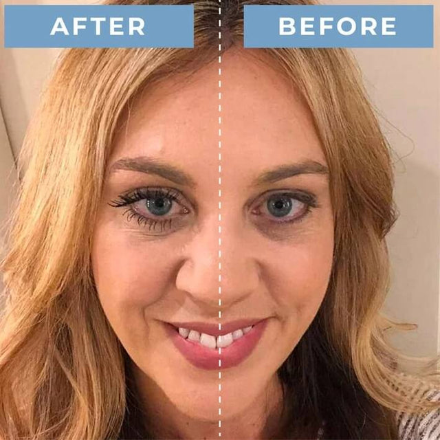 Final 3 Hours: 60% OFF🔥 PerpetuLash Eyelash
