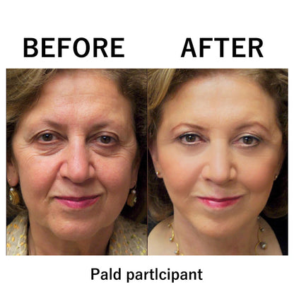 🔥 Last Day Discount: 87% OFF 🌸Instant  Face Tightener