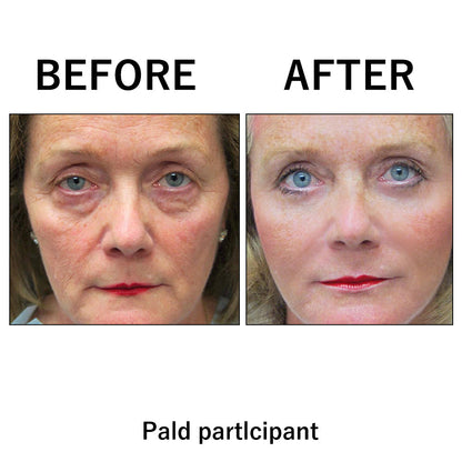 🔥 Last Day Discount: 87% OFF 🌸Instant  Face Tightener