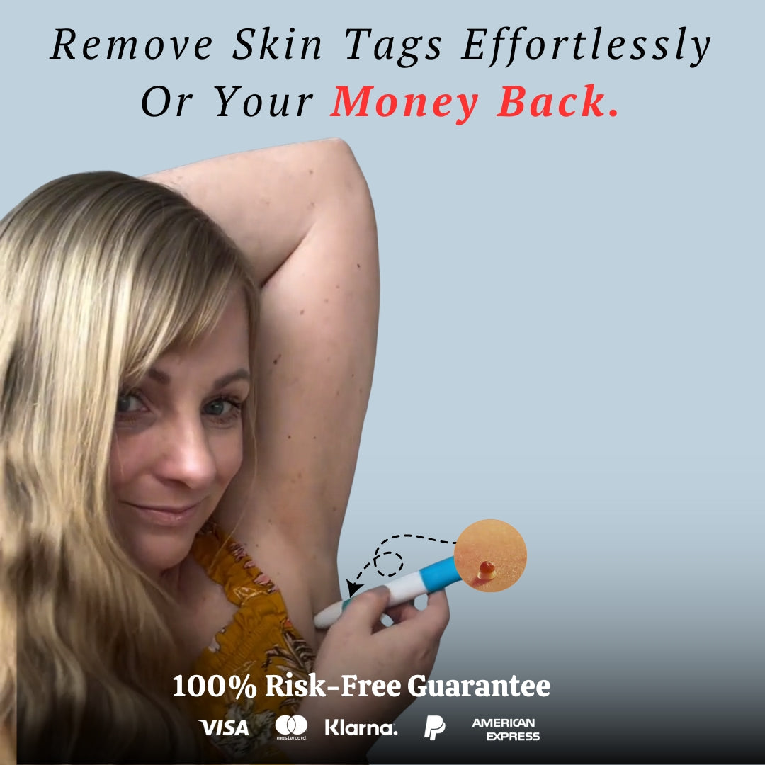 DermaTag  Removal Kit
