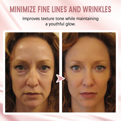 Hza Second Gen Instant Wrinkle Eraser 16 DM 20250319153640 001