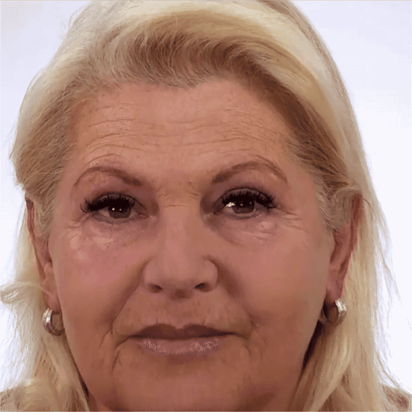 Hza Second Gen Instant Wrinkle Eraser 17 DM 20250319153806 001