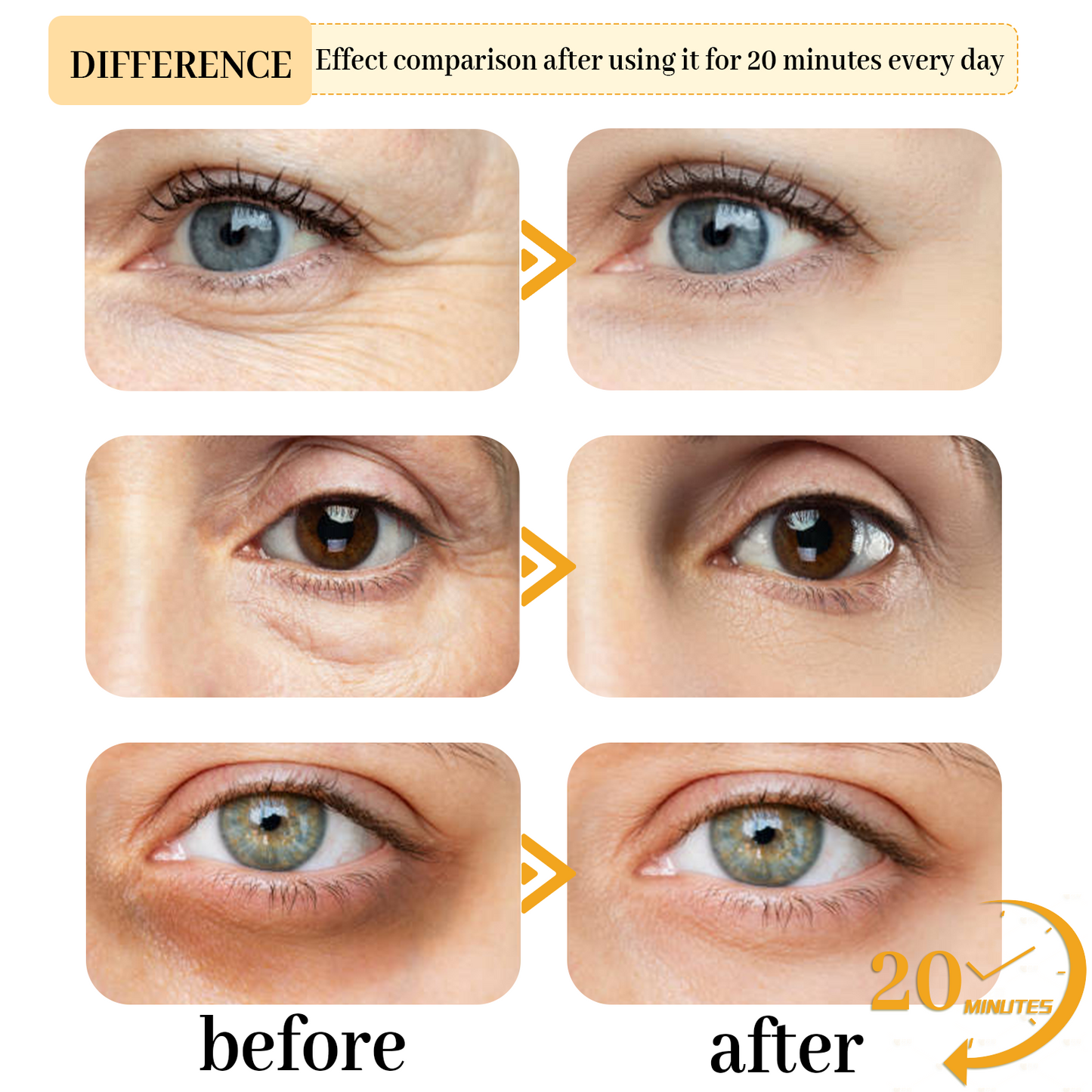 ✨🩵𝐋𝐚𝐬𝐭 𝐃𝐚𝐲 𝐃𝐢𝐬𝐜𝐨𝐮𝐧𝐭: 87% 𝐎𝐅𝐅🌸LOVILDS™ Anti-Aging Eye Serum Mask